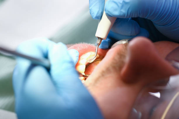 Best Emergency Treatment for Dental Infections or Abscesses in Cuero, TX