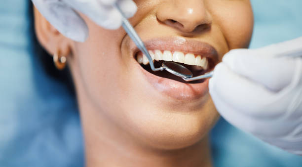 Best Emergency Wisdom Teeth Removal in Cuero, TX